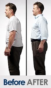 before-after-posture-correction-men